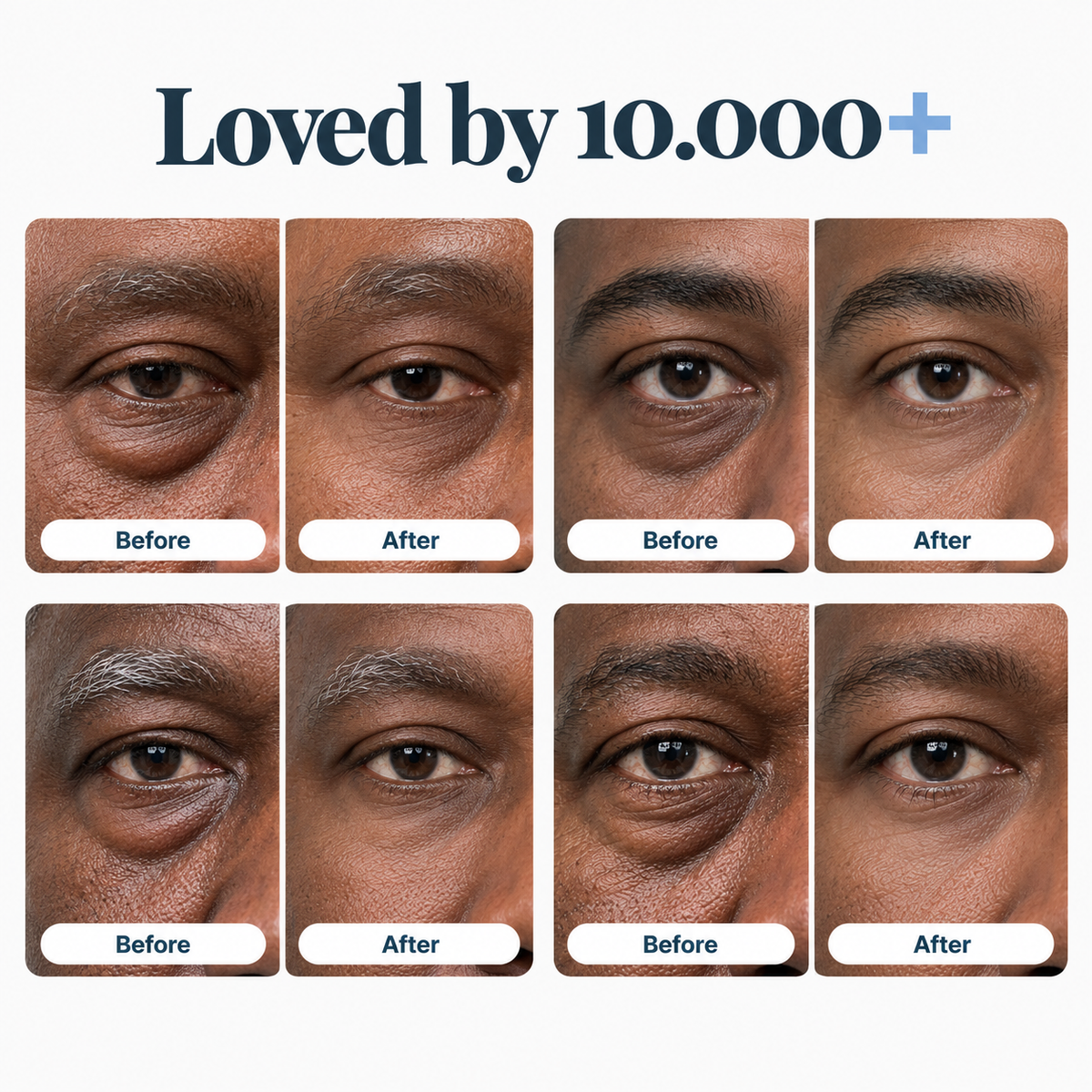 Under-Eye Renewal Balm